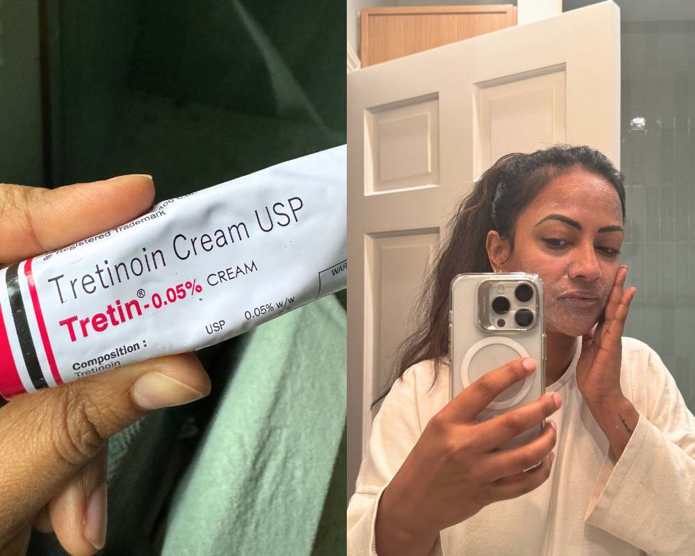 Devanshi Garg Sareen talks about her tretinoin results
