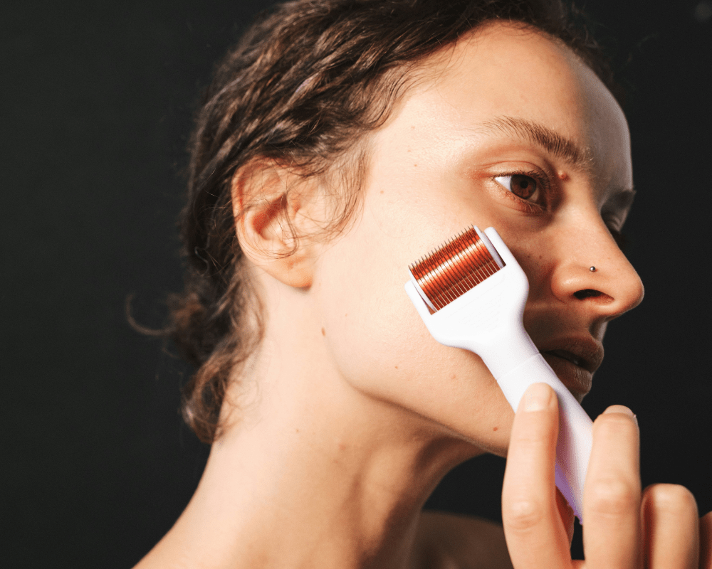  Microneedling Before and After with Aftercare and Recovery Tips 