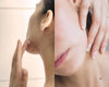  Damaged skin barrier signs include dry and flaky skin, sensitive skin, and irritated skin 