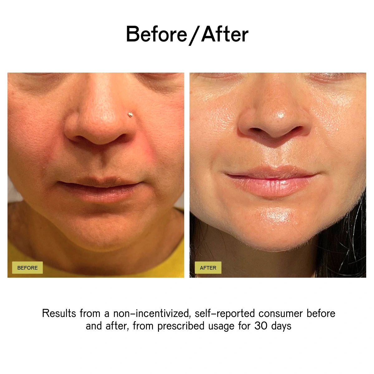 RENEW Resurfacing Peptide Toner Treatment