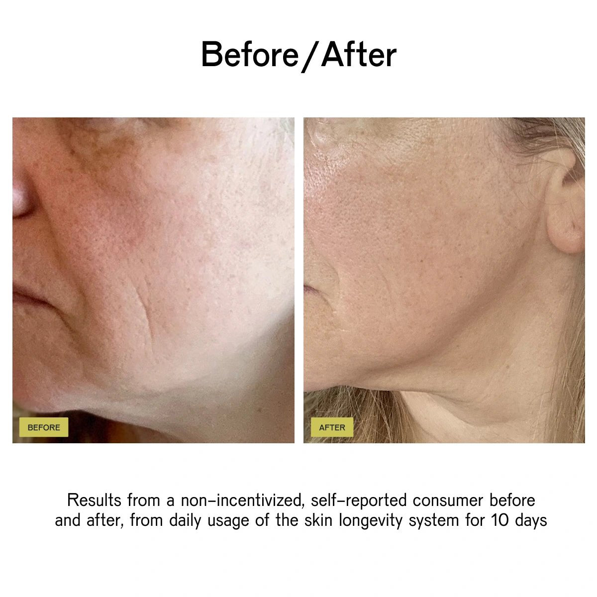 Skin Longevity System