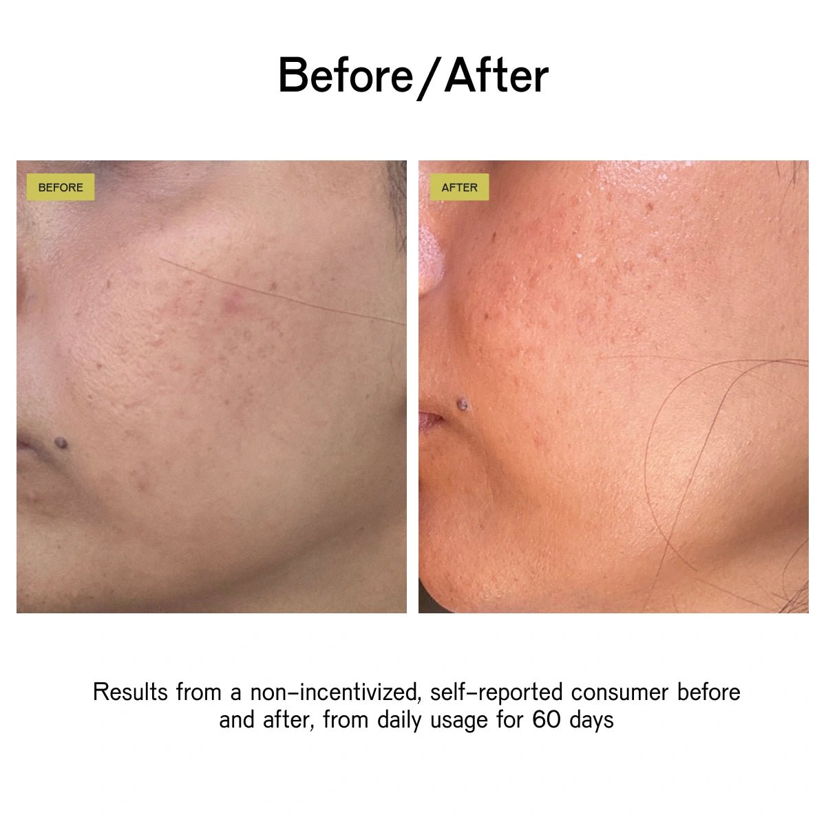 POWER Brightening Bicelle Serum
