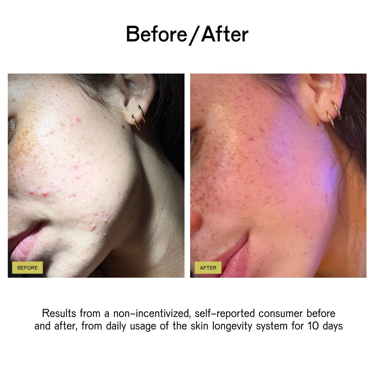 Skin Longevity System