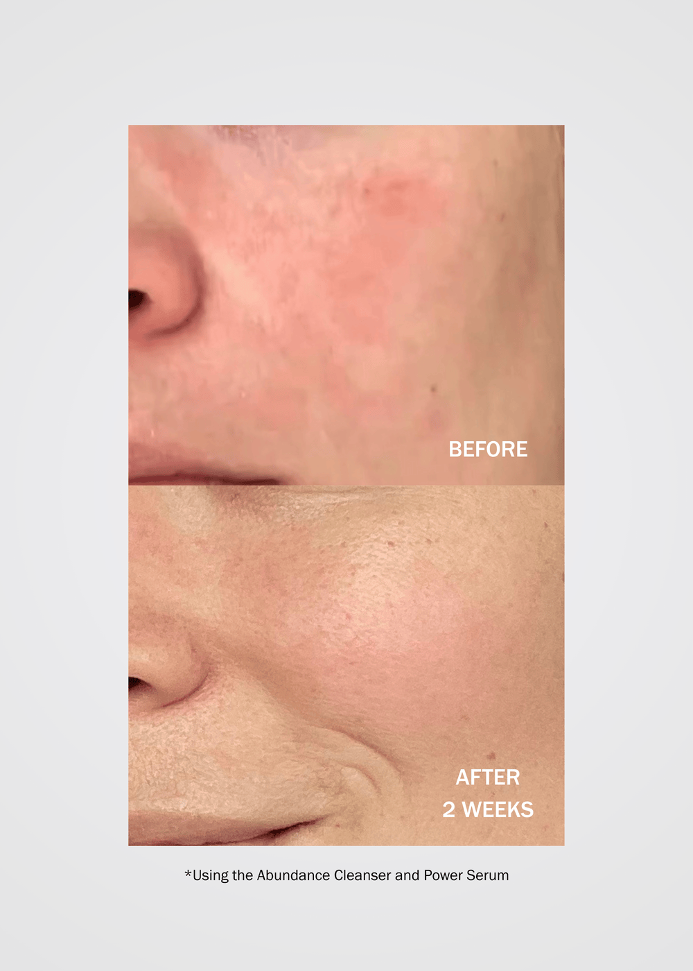  Abundance Cleanser, Renew Toner & Power Serum 