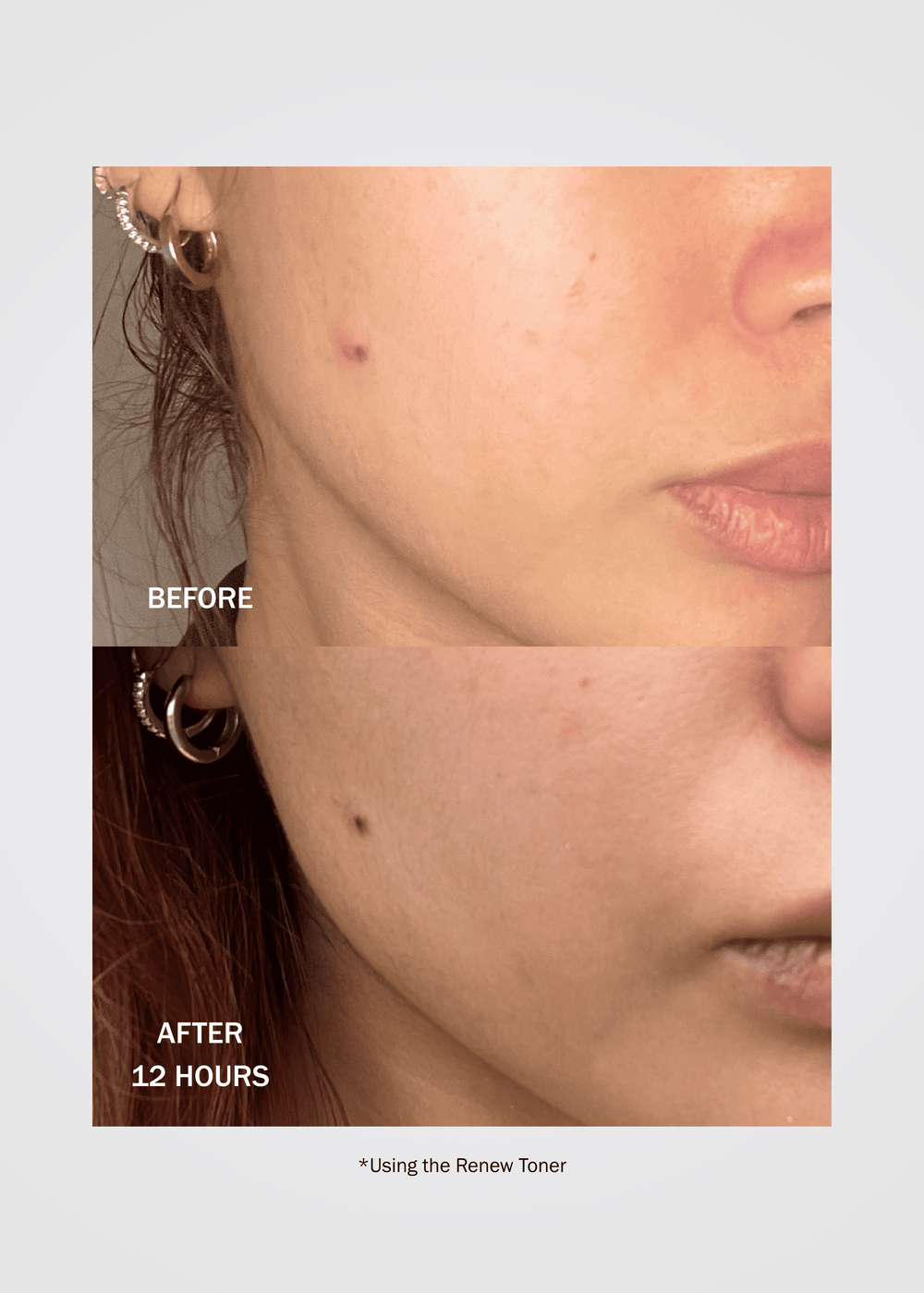  Renew Resurfacing Peptide Toner 