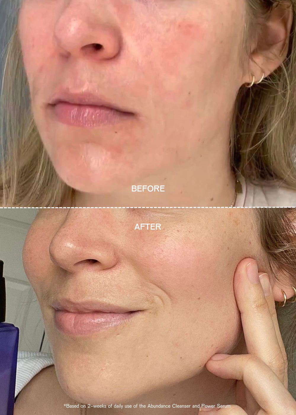 ceramide face cleanser and brightening face serum before and after 